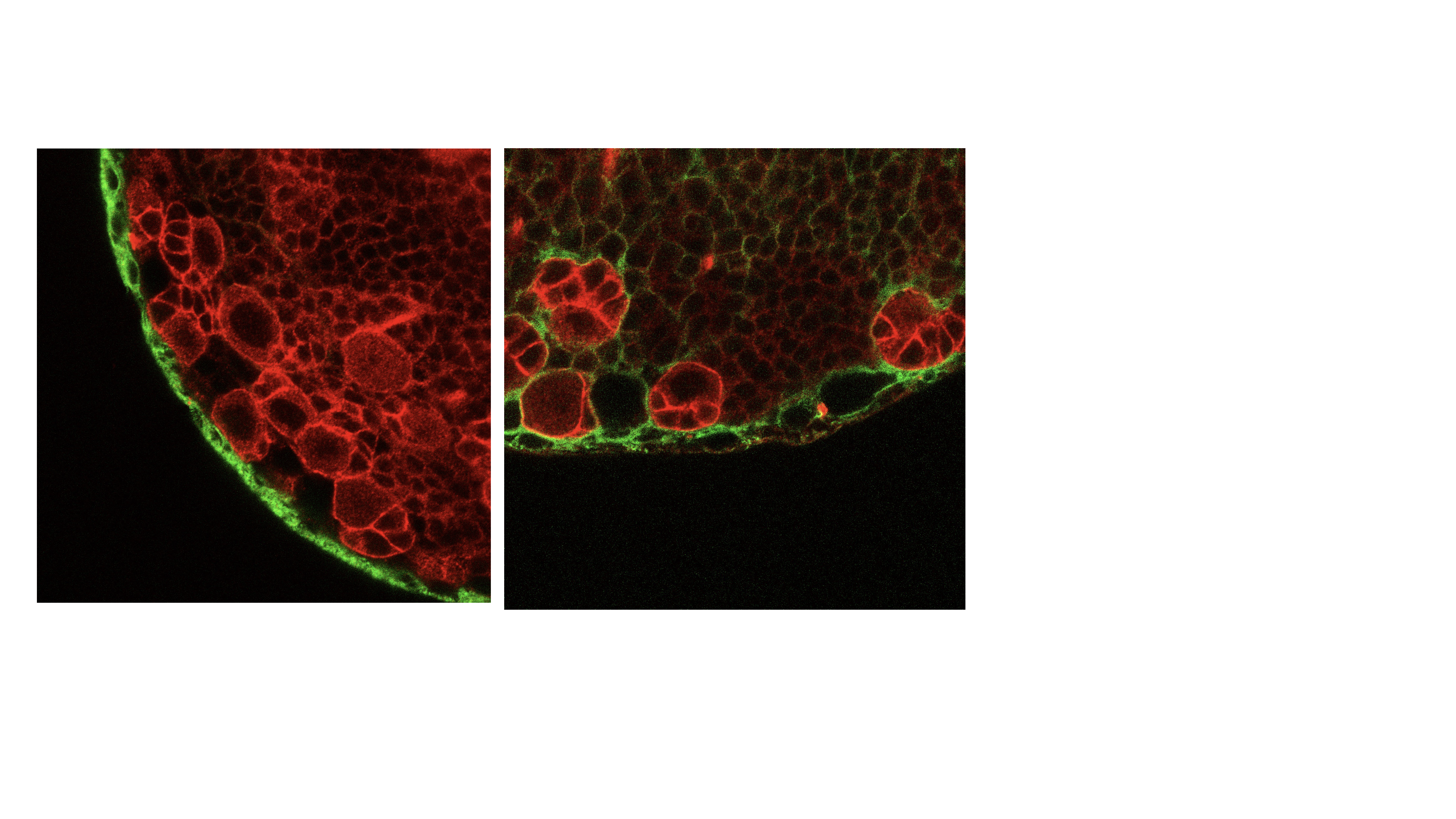 Brain glia MJK