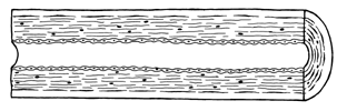 Artery Cross Section