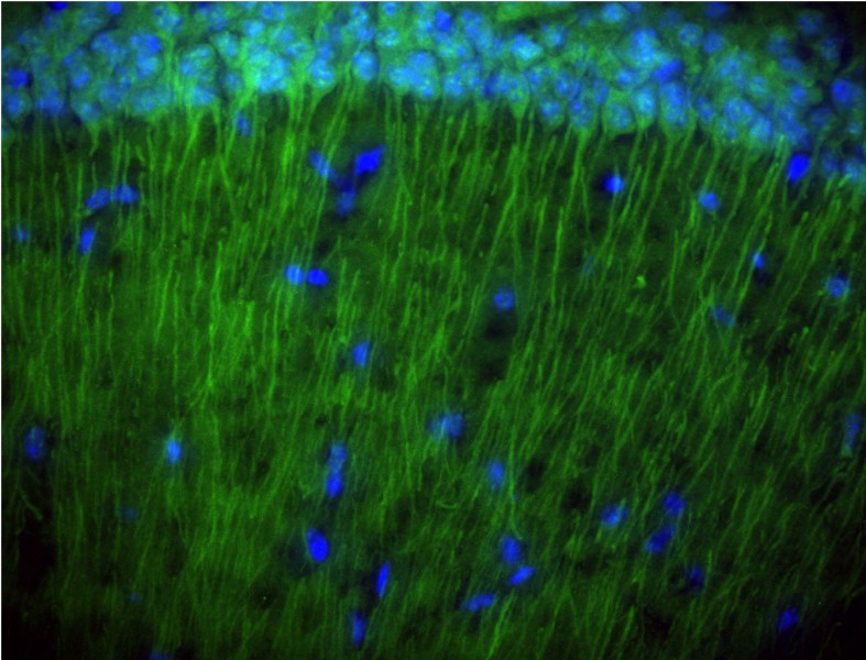 Regulating synapse growth