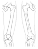 Femurs